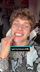 Exciting Braces Removal After 3 Years