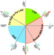 A Quick And Easy Method Of Estimating Cardiac Axis With Some