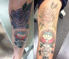 Get This Off Of Me Picosure Laser Tattoo Removal On Knee Tattoo Tattooremovalpicosure Knee Tattoo Laser Tattoo Removal Laser Tattoo