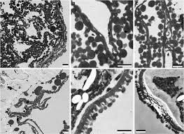 Image result for Hypolytrum goetghebeur