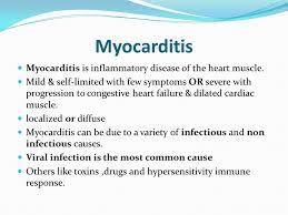 Are myocarditis and pericarditis contagious? Myocarditis And Pericarditis Ppt Video Online Download