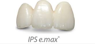 Ips E Max Crowns Teeth Manufacturer From Greater Noida