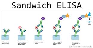 Once you understand the principle of each type of elisa, you will have to decide which elisa technique you want to use. Sandwich Elisa Steps And Advantages Microbe Notes