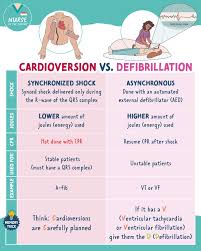 Image result for Synchronized Cardioversion