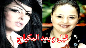 رغم ظهورها بوزن زائد في برنامج سوبر ستار إلا أن الجمهور عشق صوت ديانا كرزون، وحازت على اللقب، لتنجر بعدها لعمليات التجميل، حيث يرى كثيرون أن ديانا كرزون كانت أجمل بملامحها الطفولية. Ø´ÙƒÙ„ ÙÙ†Ø§Ù†Ø§Øª Ø§Ù„Ø¹Ø±Ø¨ Ù‚Ø¨Ù„ ÙˆØ¨Ø¹Ø¯ Ø¹Ù…Ù„ÙŠØ§Øª Ø§Ù„ØªØ¬Ù…ÙŠÙ„ Ù„Ù† ØªØµØ¯Ù‚ Ù…Ø§ Ø³ÙˆÙ ØªØ´Ø§Ù‡Ø¯Ø© Ù„Ø§ ÙŠÙÙˆØªÙƒ Youtube