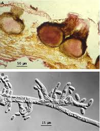 Image result for Pseudopeziza tracheiphila
