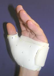 Sprained Thumb - Orthoinfo - Aaos