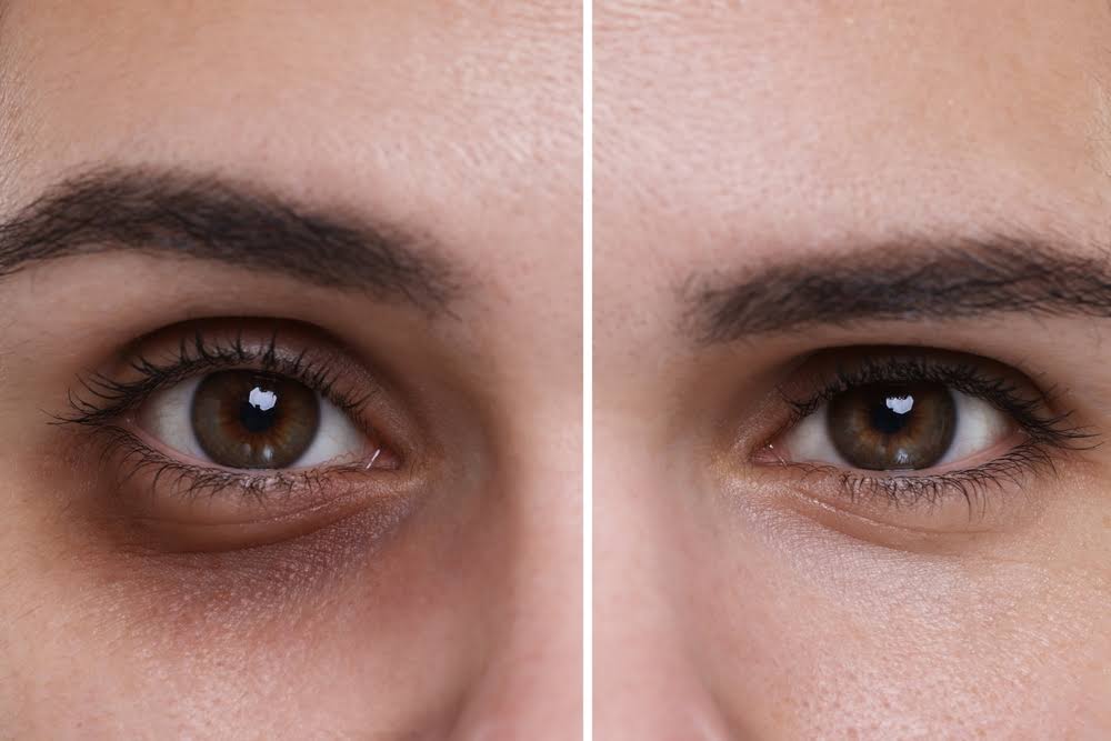 Dark circles product image