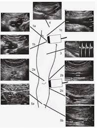 Only some urgent care centers can do ultrasounds because only some urgent care centers need to be able to do it. Does Urgent Care Have An Ultrasound Edukasi News