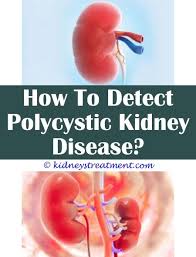 Kidney Cleanse Apple Cider Vinegar Polycystic Kidney Disease Chronic Kidney Disease Kidney Infection