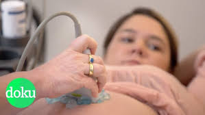 Schlaganfall mit 26: Ina, Vanessa (‪@CoupleOnTour‬) und ihre bewegende  Geschichte