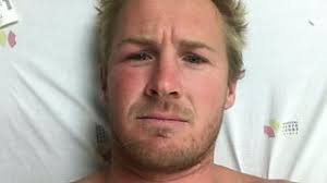 Surfer Andrew Cotton has back broken by 60-foot wave