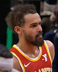 Is Trae Young Balding? How His Hair Has Changed