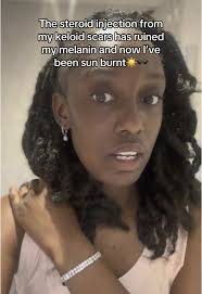 Keloid Scars and Sun Exposure: My Experience with Steroids