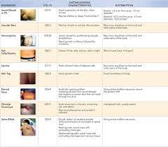Midline Back Pits Skin Tags Hair Tufts And Other Lesions Visual Diagnosis And Treatment In Pediatrics 3 Ed