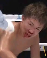 The stage is set tonight at the Aichi Sky Expo in Tokoname, Japan as former  three-division world champion John Riel “Quadro Alas” Casimero steps into  enemy territory against Japan's Tom Mizokoshi in