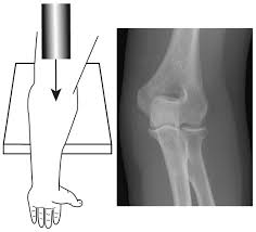 Startradiology