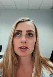 coldsore #hsv1 #coldsores