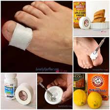 Natural Remedies To Remove Corn And Calluses From Feet Home Health Remedies Foot Remedies Natural Remedies