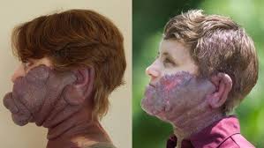 I Had To Choose Between My Voice and My Face