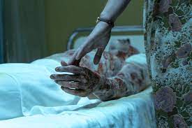 As sick patients begin to stream into the local hospital, a skeptical academician, valery legasov, is tasked by the central committee of the ussr to serve as an expert on its chernobyl task force. How Chernobyl Makeup Designer Captured Horrific Bodily Decay Deadline