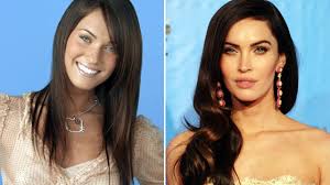 She was born in oak ridge, tennessee. Megan Fox Plastic Surgery Youtube