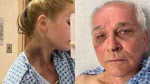 BLASTED OUT OF MY SHOES." A father and daughter who traveled to Tampa from  Chicago to watch the Yankees play were struck by lightning this weekend.  They were released from the hospital