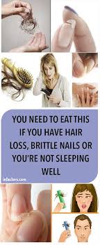 You Need To Eat This If You Have Hair Loss Brittle Nails Or You Re Not Sleeping Well Healt Biotin For Hair Loss Hair Loss Cure Postpartum Hair Loss Remedies