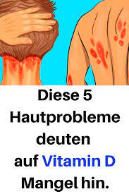 Vitamin d ist eine gruppe fettlöslicher vitamine, die zu den secosteroiden gehören und in der physiologie vor allem für ihre rolle beim calciumstoffwechsel bekannt sind. Diese 5 Hautprobleme Deuten Auf Vitamin D Mangel Hin Hautprobleme Vitamin Mangel Tipps Healthy Life Healthy Life