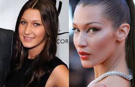 Bella Hadid Surgery How Fashion Industry Promotes Body Image Issues