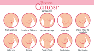 There are several kinds of breast cancer. Breast Cancer Awareness Symptoms And Signs Of Breast Cancer
