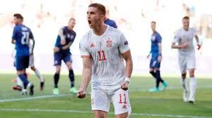 Slovakia started well with a win against poland but then lost to sweden in their last match. Tp26b5 Rtkle M