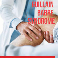 It is an acute and rapidly progressive inflammation of nerves that causes loss of sensation and muscle weakness. Guillain Barre Syndrome Guillain Barre Syndrome Gbs Is A By Ava Rehab Medium