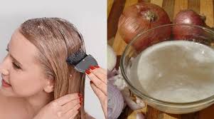 Onions have many potential health benefits. Is Onion Juice Good For Hair Growth Does It Work For Hair Quillcraze
