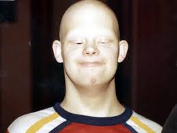 Scott Stein Obituary