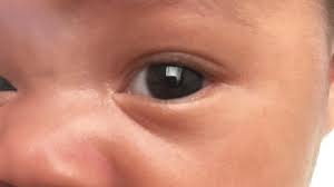 eye color how do hazel eyes start out babycenter