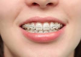 Each of us needs to find the right we often believe we can't afford the time it takes, but the opposite is true: 24 Hour Emergency Dental Clinic Near Me Braces Tips Teeth Braces Braces Off