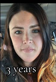 I need your help 🤍 #chronicpancreatitis #chronicillnesstiktok #chronicpain  #pancreatitis