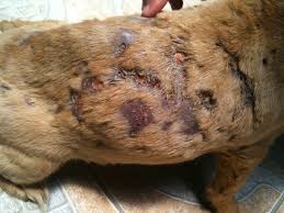 Image result for Panniculitis