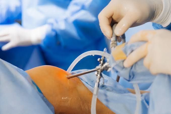 Spine surgery