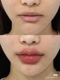 Frazer Lee (frazerbrynnlee) — профиль