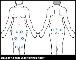 Painful lump on hip symptoms explained painful hip lump causes how and when to treat a painful hip lump faqs about painful hip lump painful hip this process begins before birth, and the cause of the gene mutation is not fully known. Hip Pain Causes Exercises Treatments Versus Arthritis