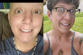 Fundraiser for Amber Marino by Brigett Bolding : Ambers Last Big Surgery  for her Breast Cancer