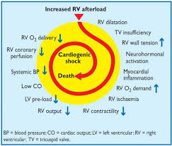 Image result for Afterload