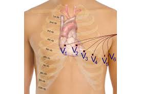 12 Lead Ecg Placement