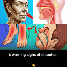 6 warning signs that you might have diabetes…👇