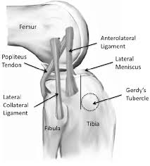Jun 28, 2020 · the use of ice packs on the knee (a tea towel wrapped around a bag of frozen peas makes a good ice pack). A Diagram Of An Anterolateral View Of The Knee Demonstrating The Download Scientific Diagram