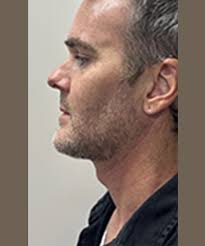 Gallery of Procedures