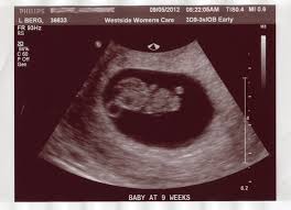 The size of the fetus at 10 weeks pregnant your little one is still growing very quickly! Ilmu Pengetahuan 2 4 Week Dog Pregnancy Ultrasound