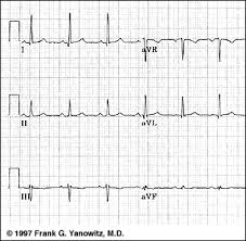 The package contains 3 tests and most questions carry detailed explanations. Ecg Learning Center Test